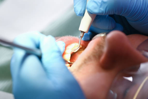 Best Emergency Dental Care for Trauma or Injury in Sturgeon, PA