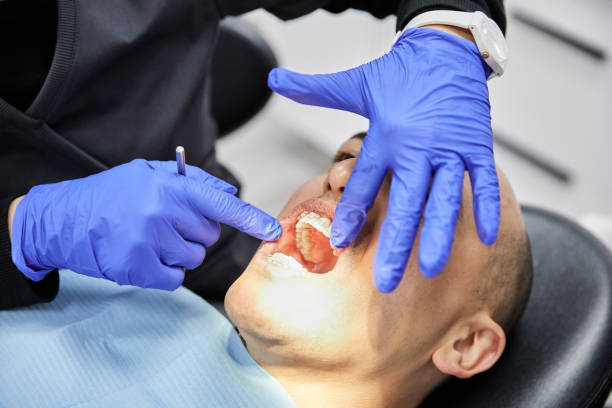 Best Emergency Broken Tooth Repair in Sturgeon, PA